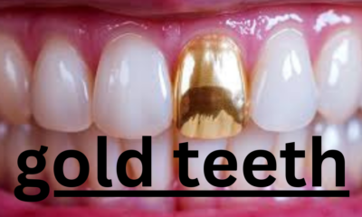 The Rise of Gold Teeth: A Cultural and Aesthetic Evolution