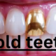 The Rise of Gold Teeth: A Cultural and Aesthetic Evolution