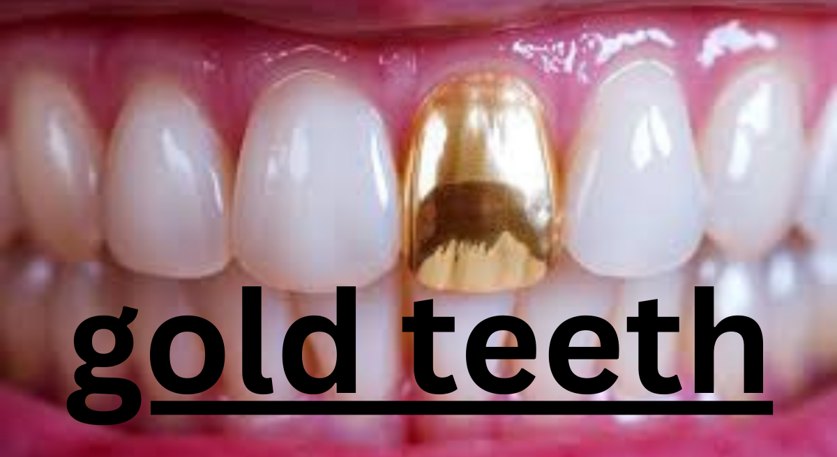 The Rise of Gold Teeth: A Cultural and Aesthetic Evolution